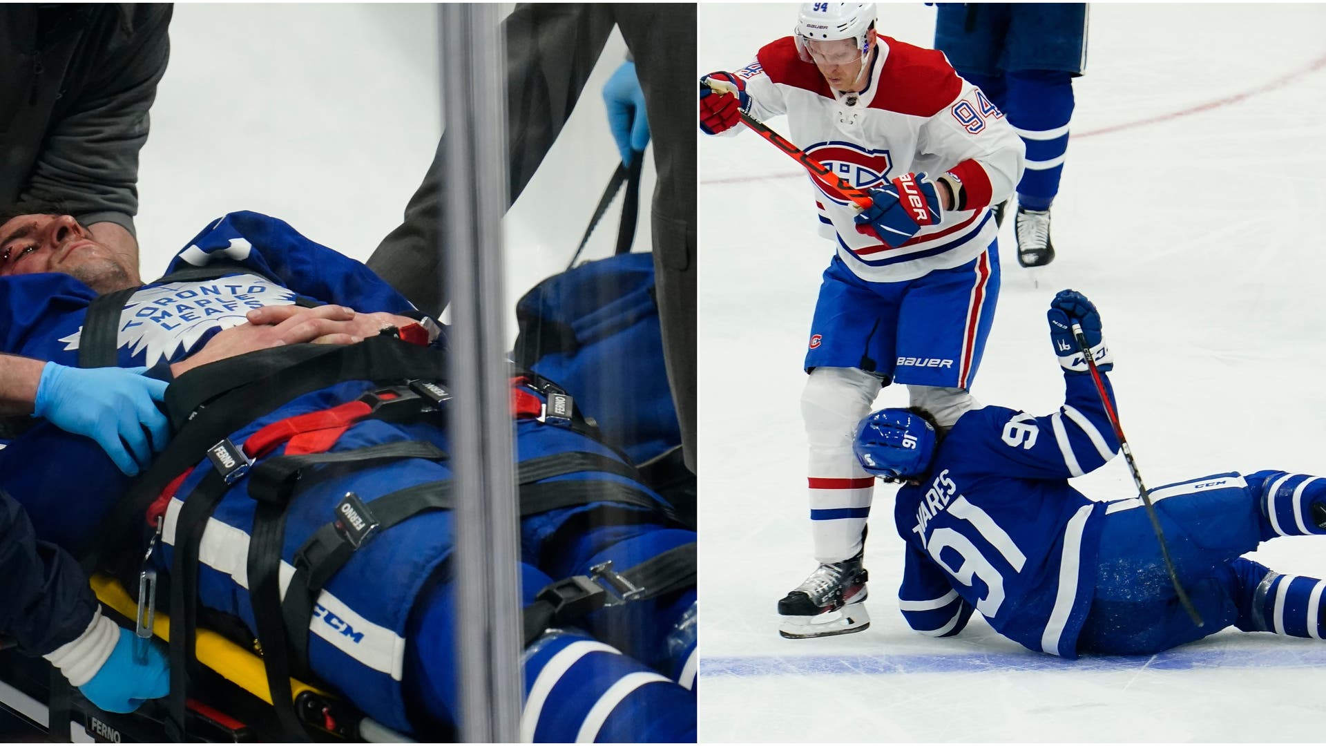 (19659) John Tavares skada