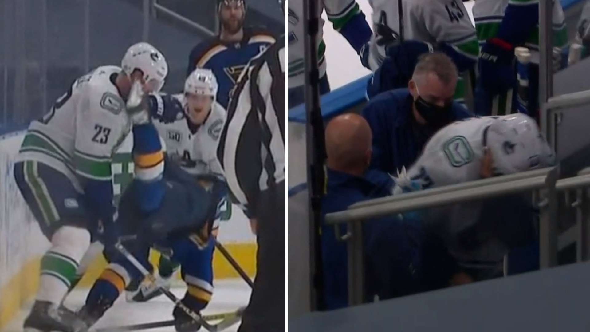 (14958) Alexander Edler skada collage