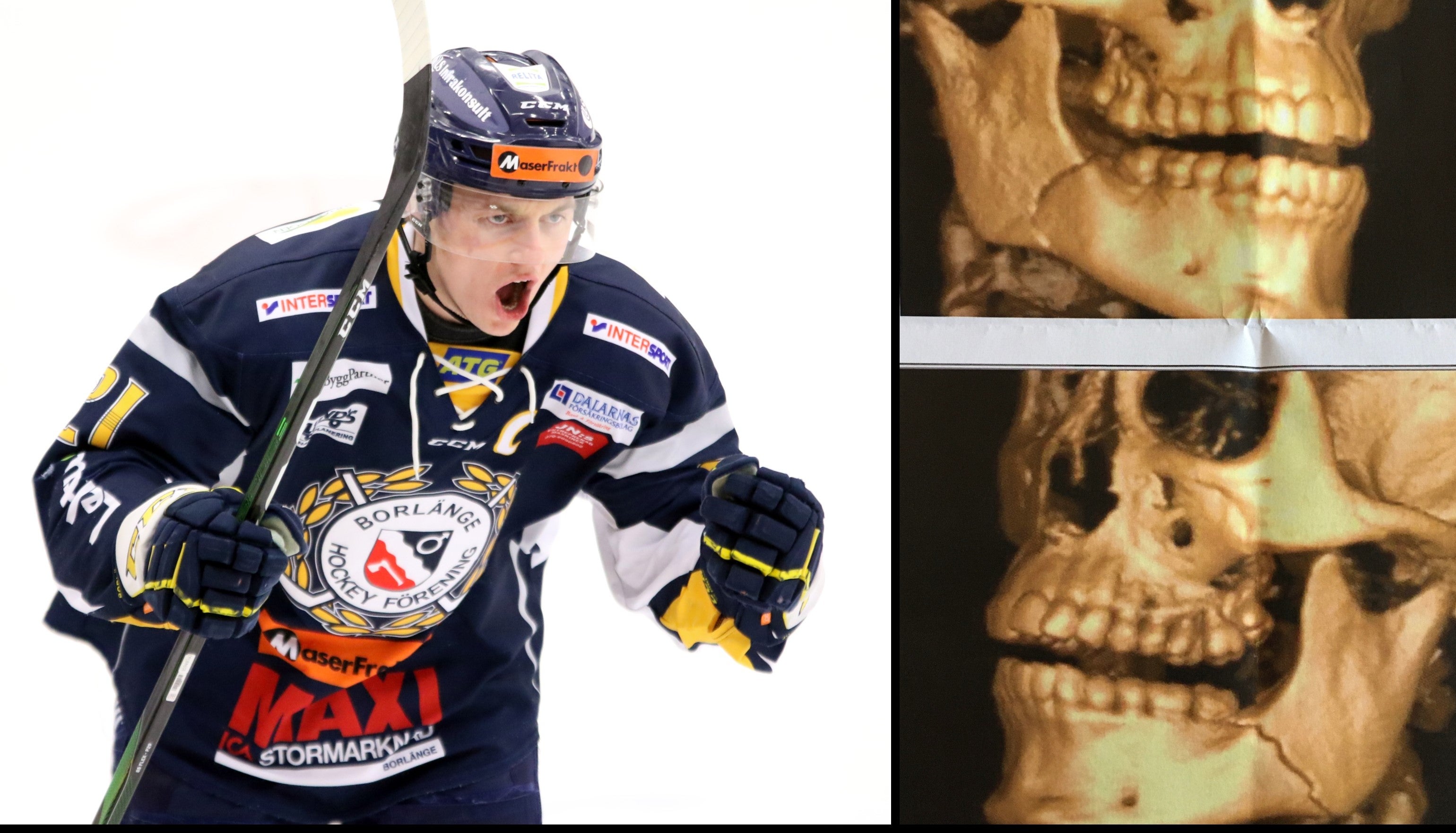 Mats Tjernström/Privat/Montage