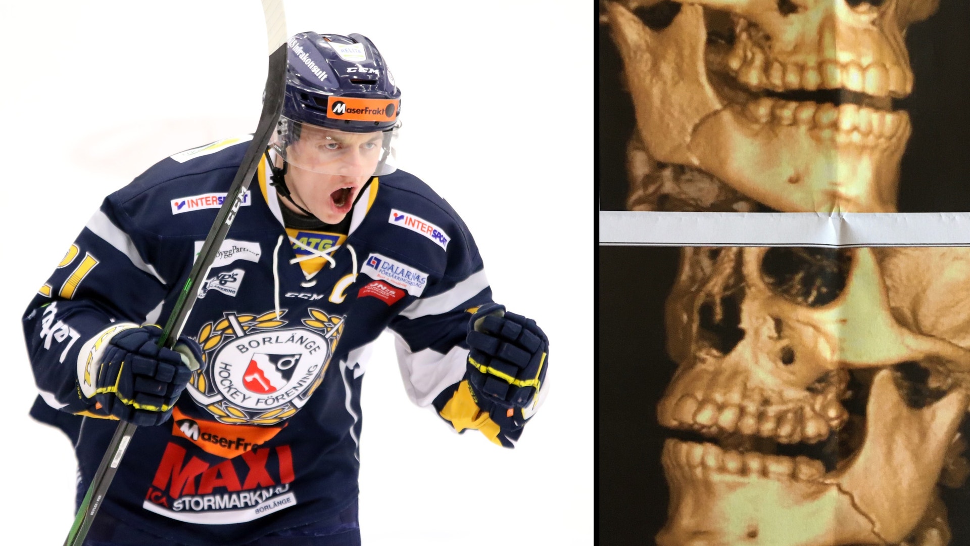 Mats Tjernström/Privat/Montage