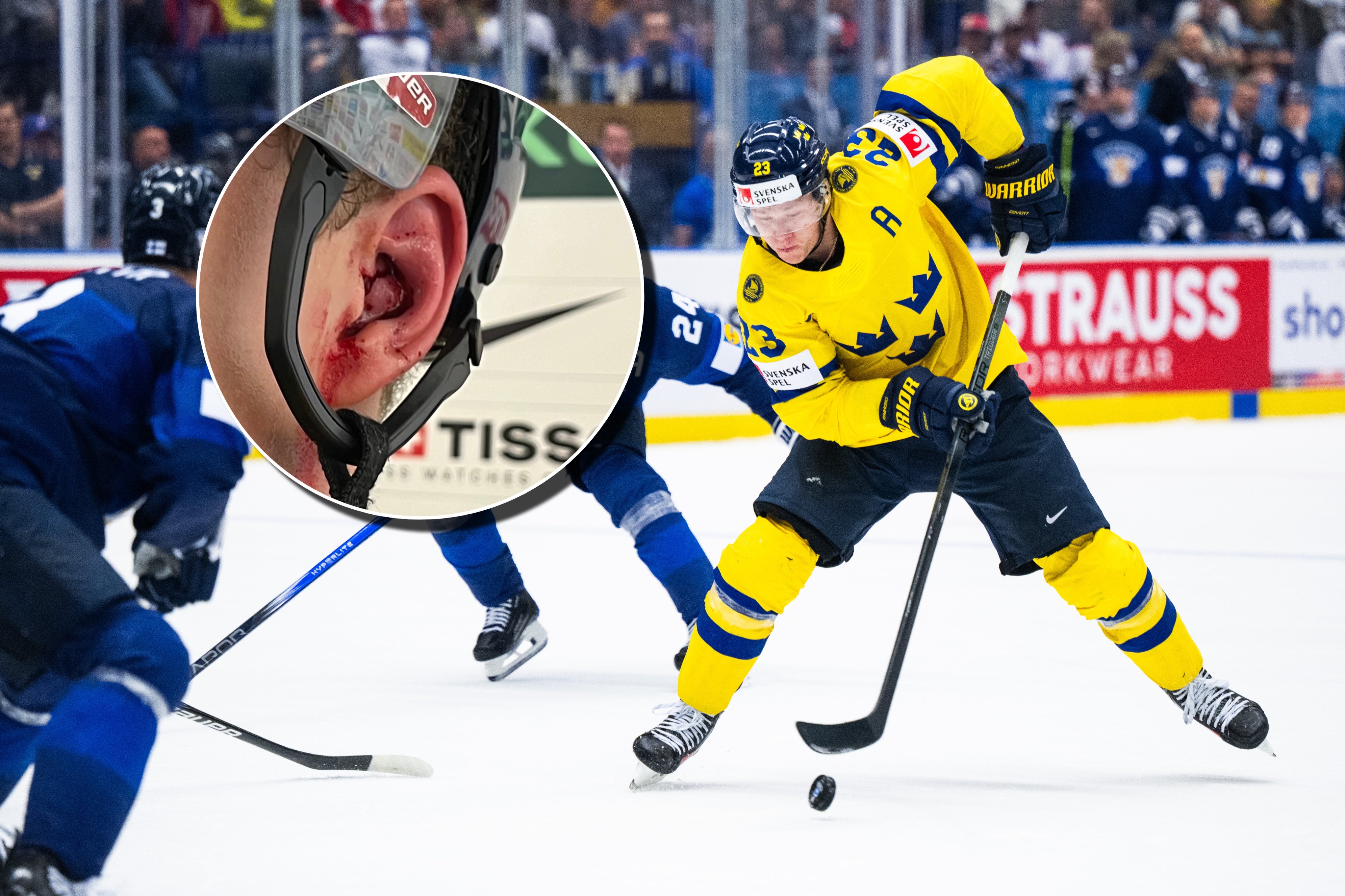 Lucas Raymond öra