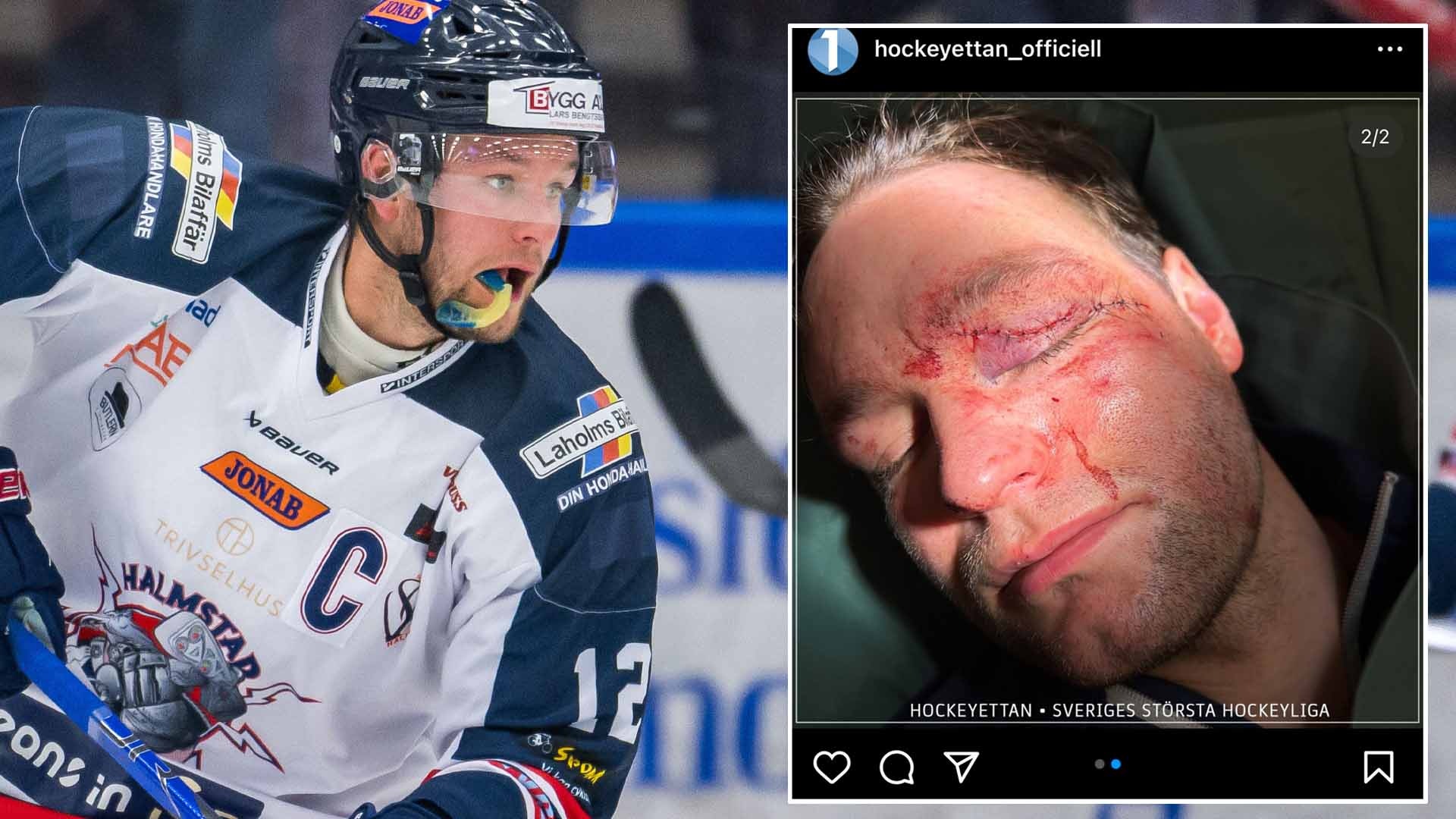 Bildbyrån / skärmdump Instagram