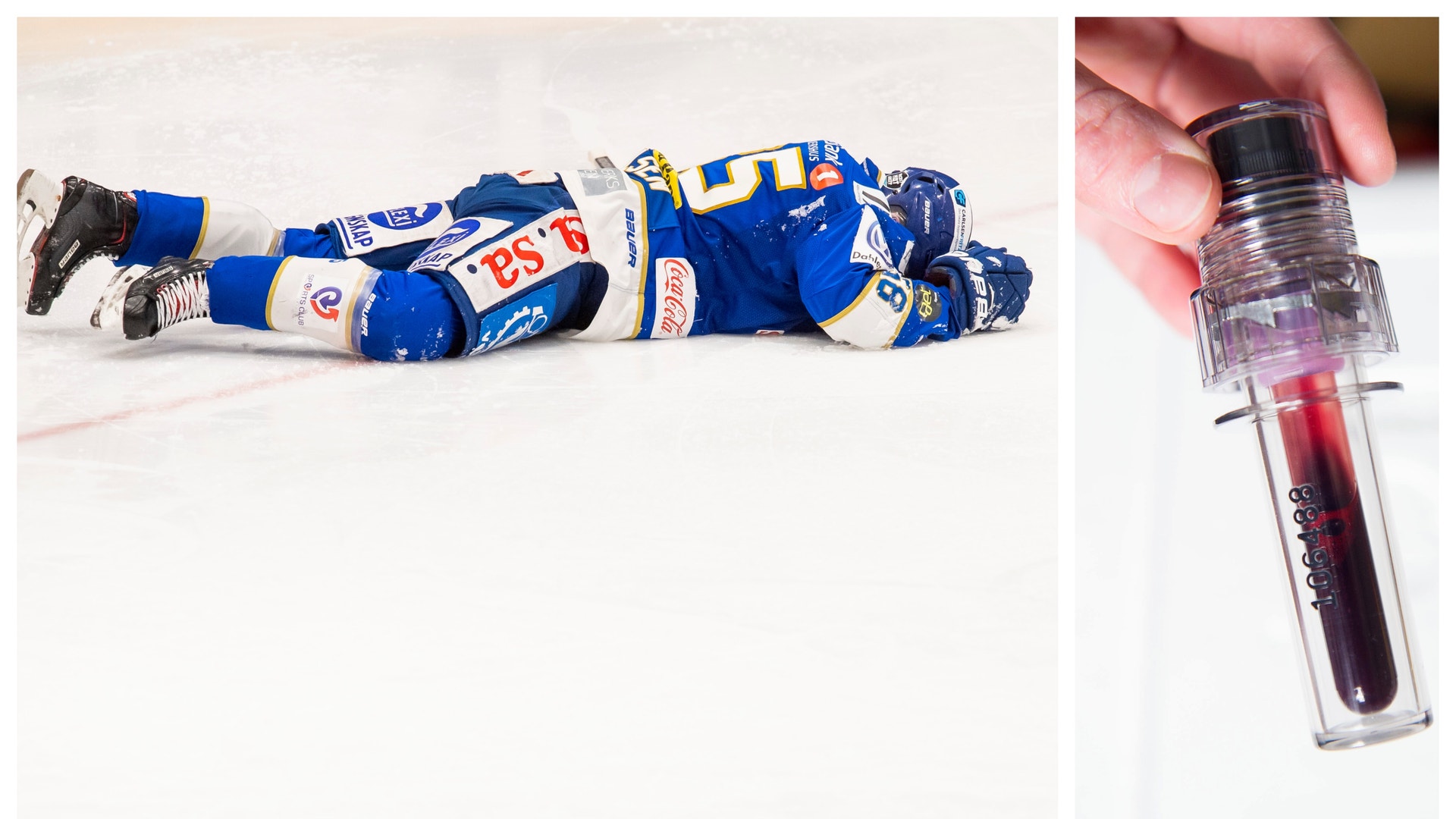 Bildbyrån/Montage
