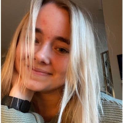 Manda Zanier