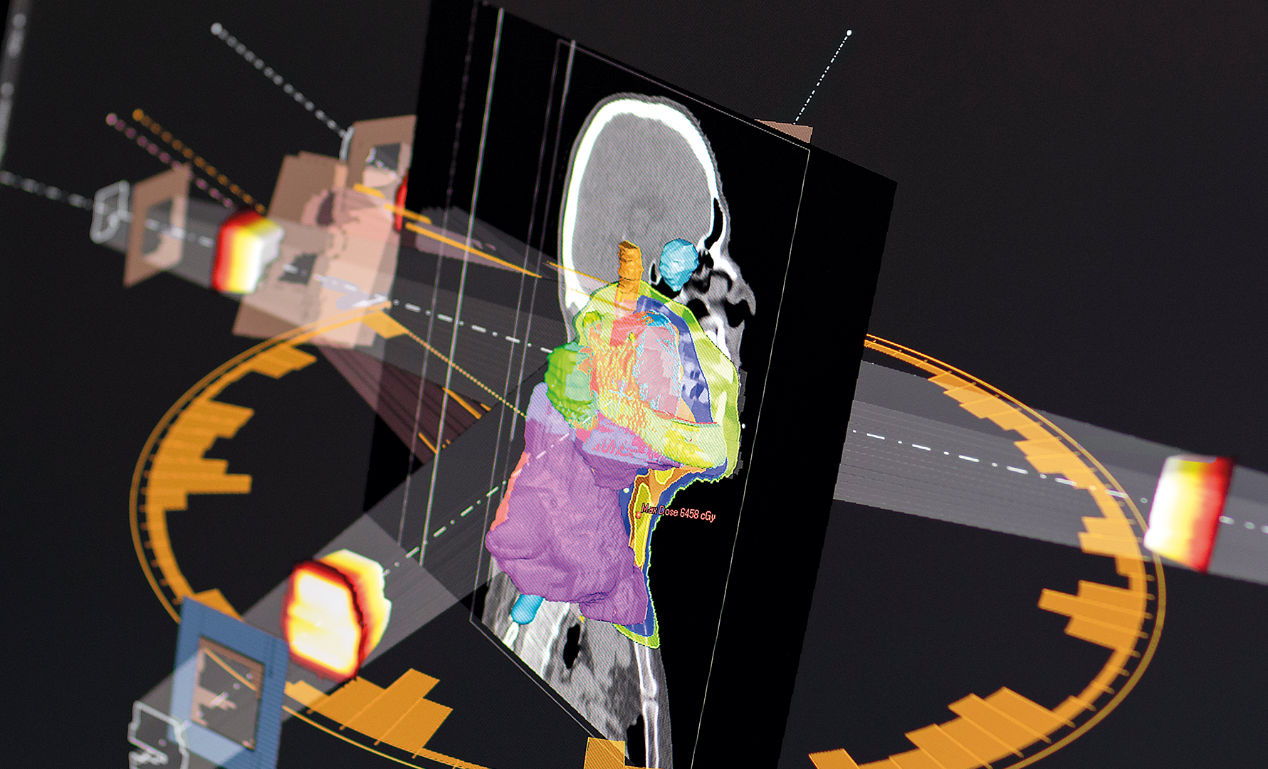 3D-visualisering av en människokropp med färgglada anatomiska överlagringar och medicinska skanningselement. Bilden visar en profil av en person omgiven av tekniska instrument, strålkällor och grafiska representationer av interna organ och kroppsstrukturer i olika färger inklusive gult, rosa, grönt och blått mot en mörk bakgrund.