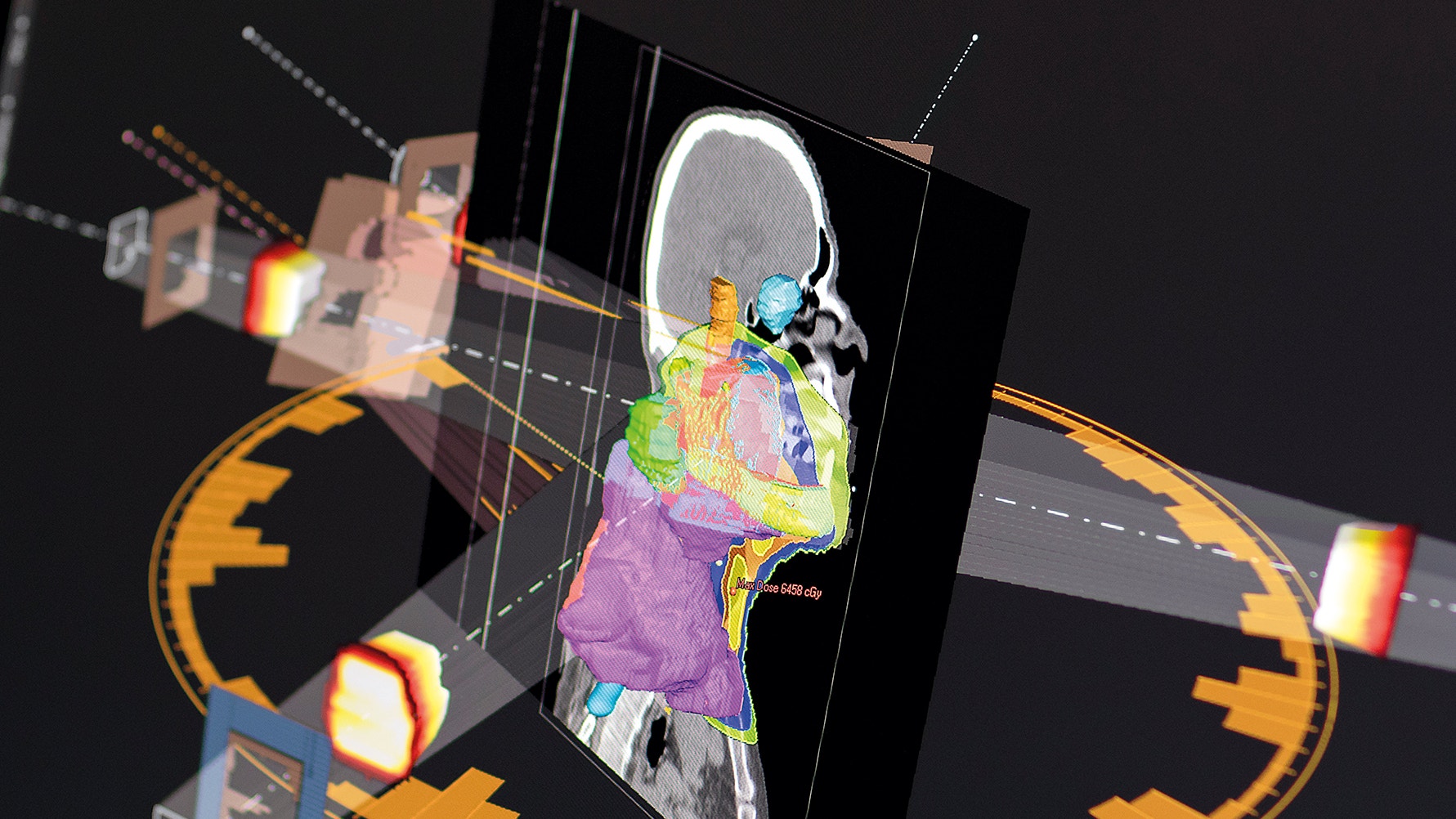 3D-visualisering av en människokropp med färgglada anatomiska överlagringar och medicinska skanningselement. Bilden visar en profil av en person omgiven av tekniska instrument, strålkällor och grafiska representationer av interna organ och kroppsstrukturer i olika färger inklusive gult, rosa, grönt och blått mot en mörk bakgrund.