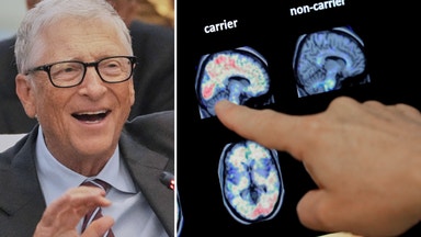 Bill Gates utlyser tävling – kan vinna 1 miljon dollar