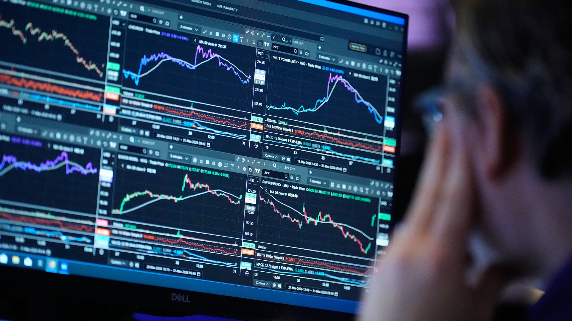 En person tittar på en datorskärm som visar finansiella diagram och aktiemarknadsgrafiker med olika färgade trendlinjer.